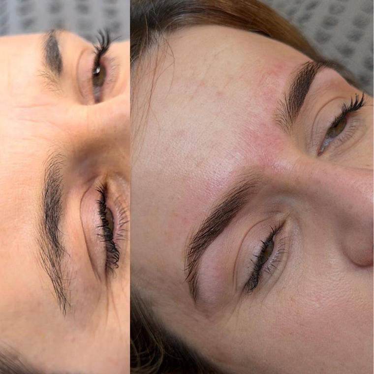 Before and after