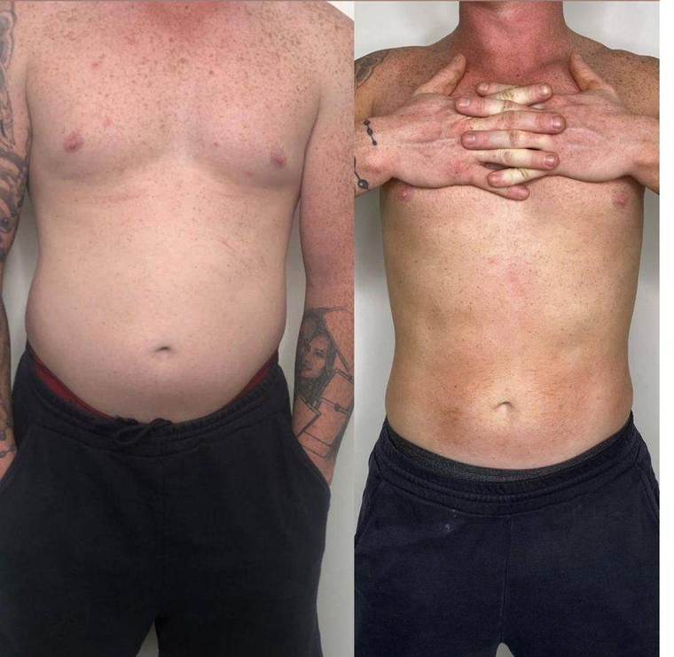 Before and after