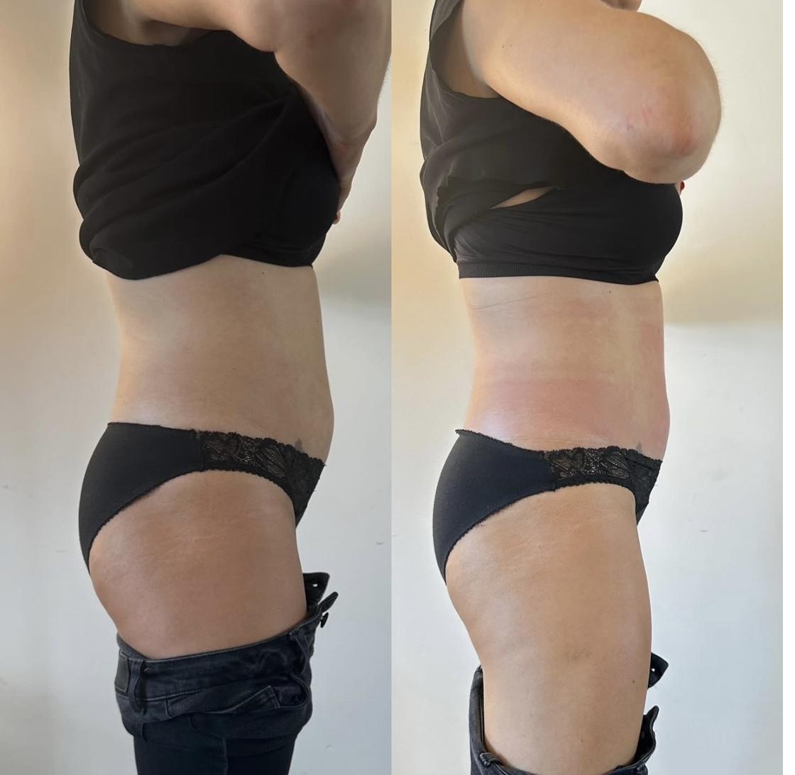 Slim Drone abdomen side