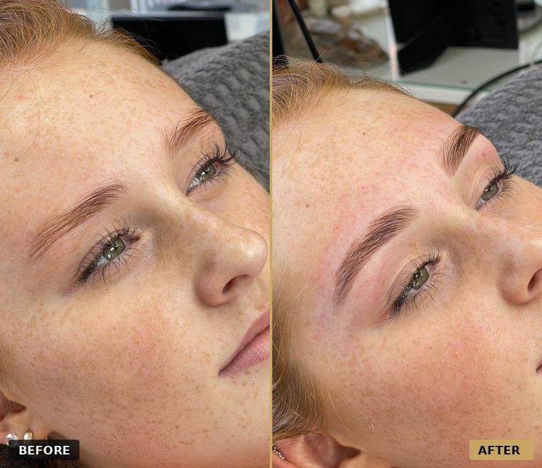 Before and after