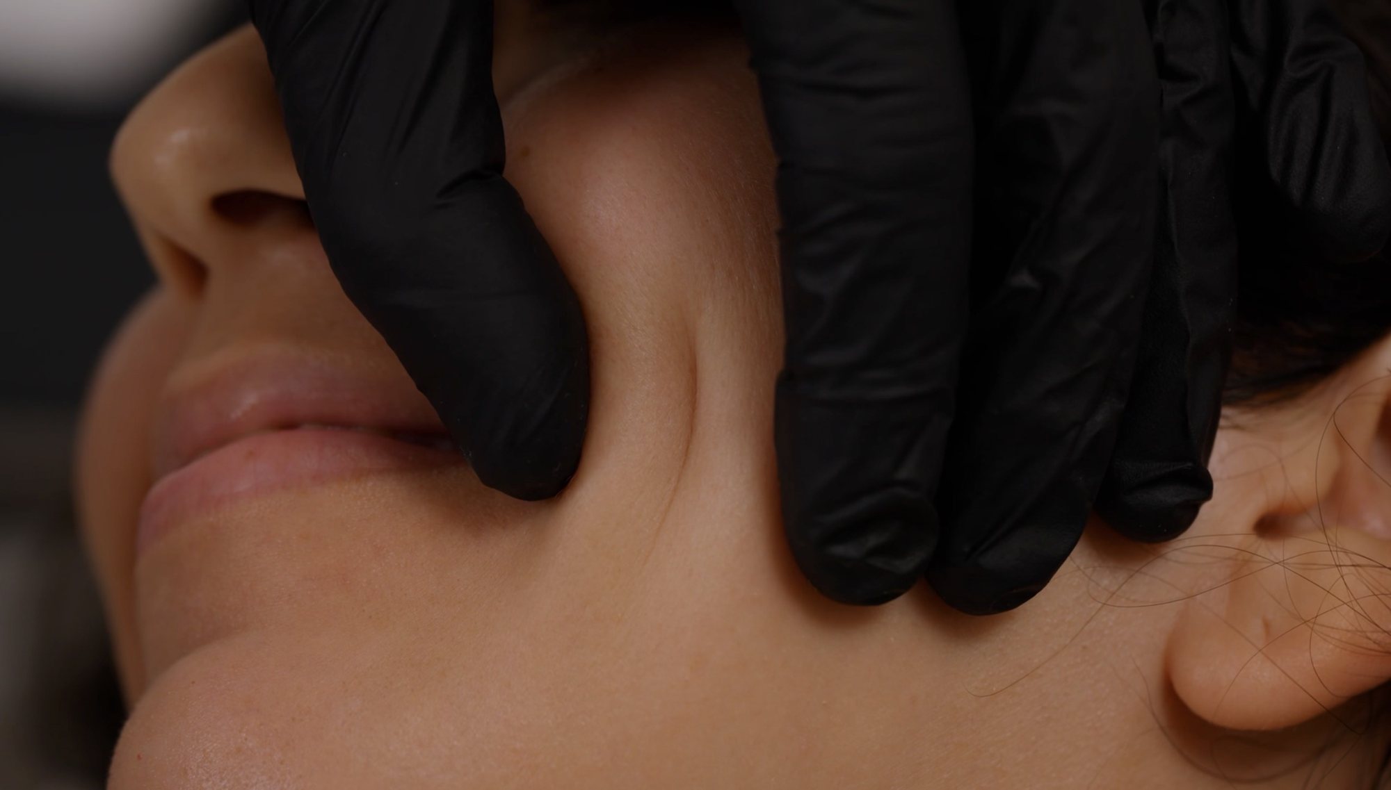 Assessing the skin before the Microdroplet Technique at Hornchurch